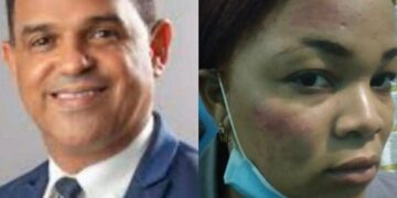 Sadoky Duarte niega maltrato a agente PN