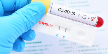 A partir del lunes, viajeros de RD tendrán que presentar prueba covid negativa para entrar a España