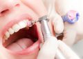 Instan a cuidar las encías para prevenir la pérdida de dientes y otros riesgos para la salud